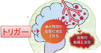 Neuroinfo Japan 脳の病気に関係する症候