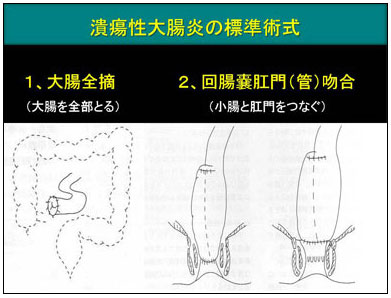 手術後に予想されること
