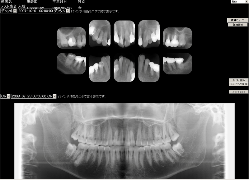 In vivo dental viewer windows 10 не запускается